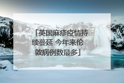 英国麻疹疫情持续蔓延 今年来伦敦病例数最多